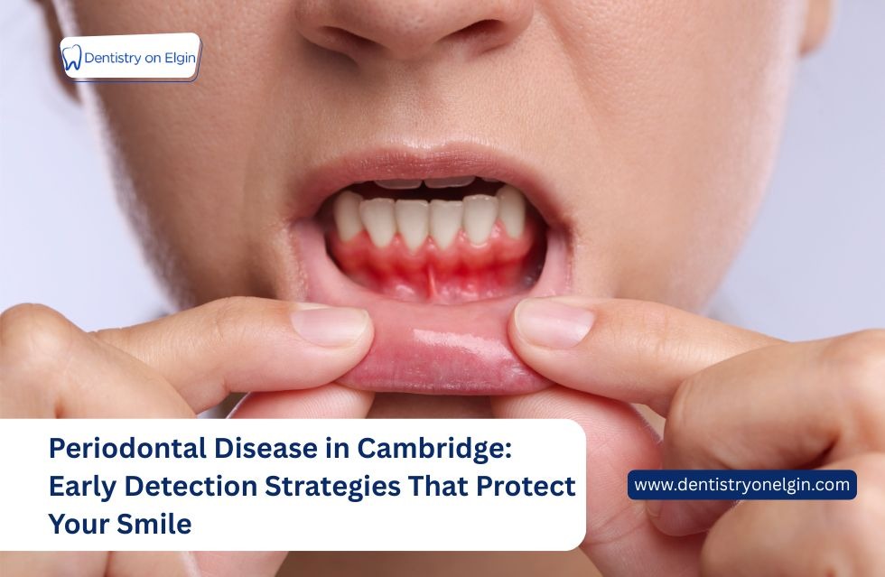 Periodontal Disease in Cambridge: Early Detection Strategies That Protect Your Smile